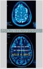 Magnetic appeal : MRI and the myth of transparency