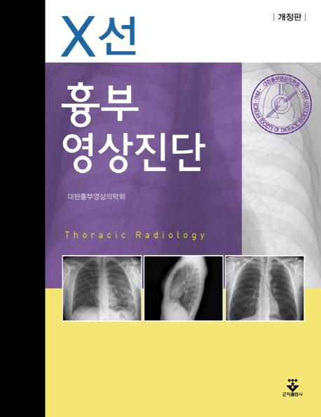 흉부 영상진단 : X선 =