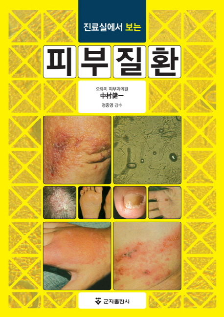 진료실에서 보는 피부질환