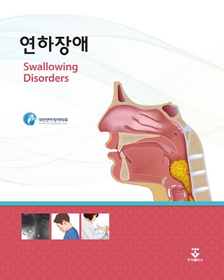 연하장애 =