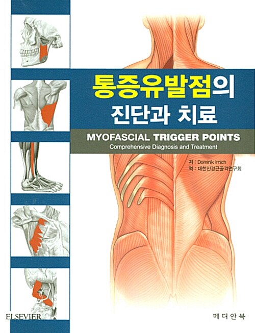 통증유발점의 진단과 치료